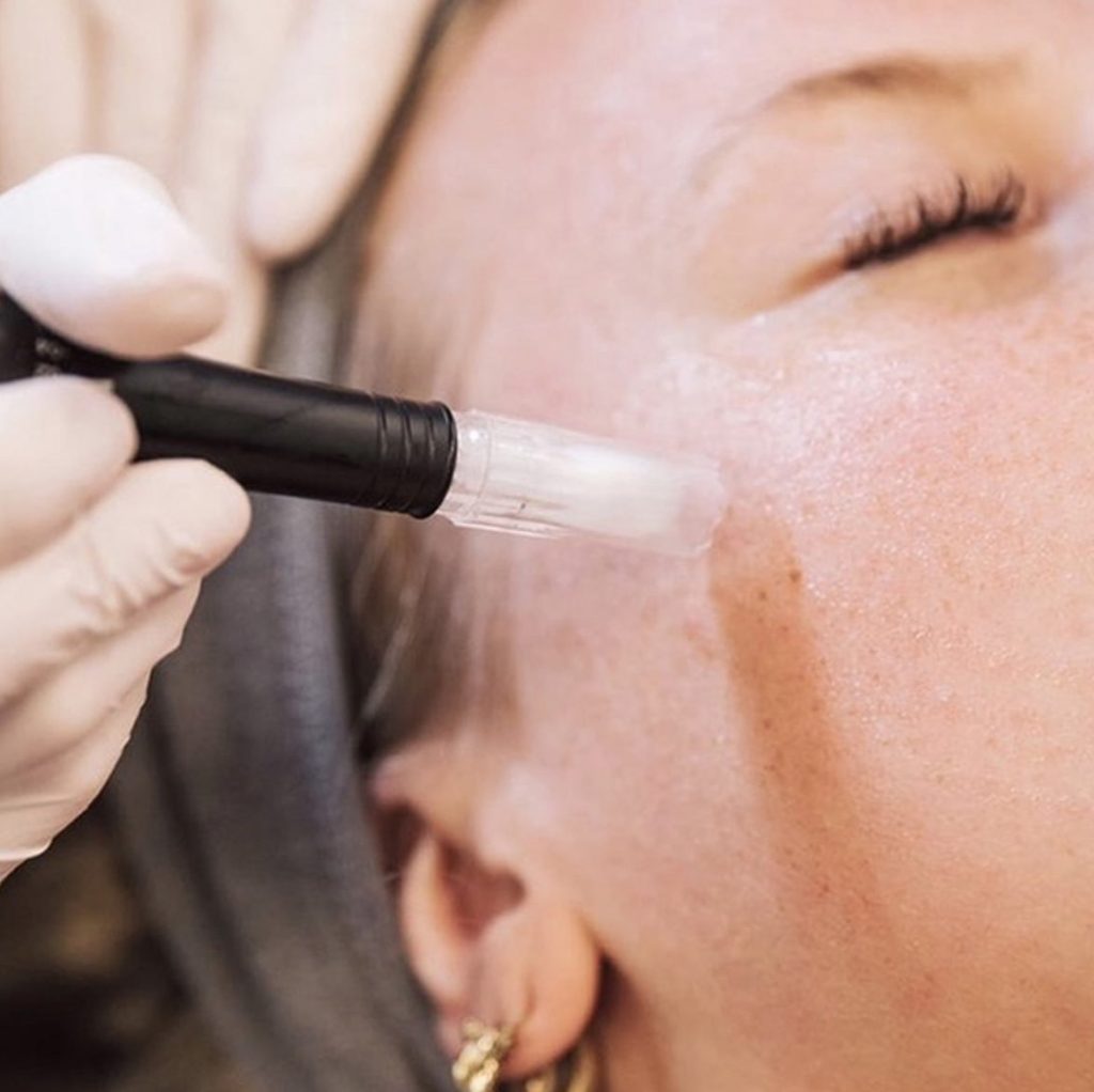 Every Face Instituut - Huidkliniek voor Mesotherapie, microneedling & meer