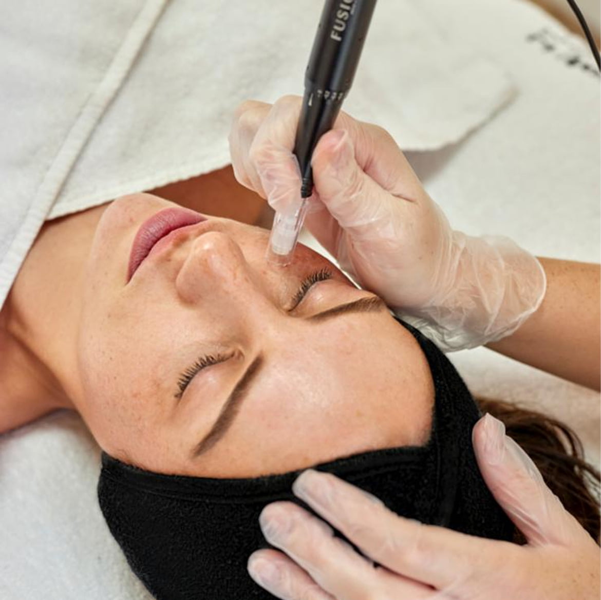 Every Face Instituut - Huidkliniek voor Mesotherapie, microneedling & meer