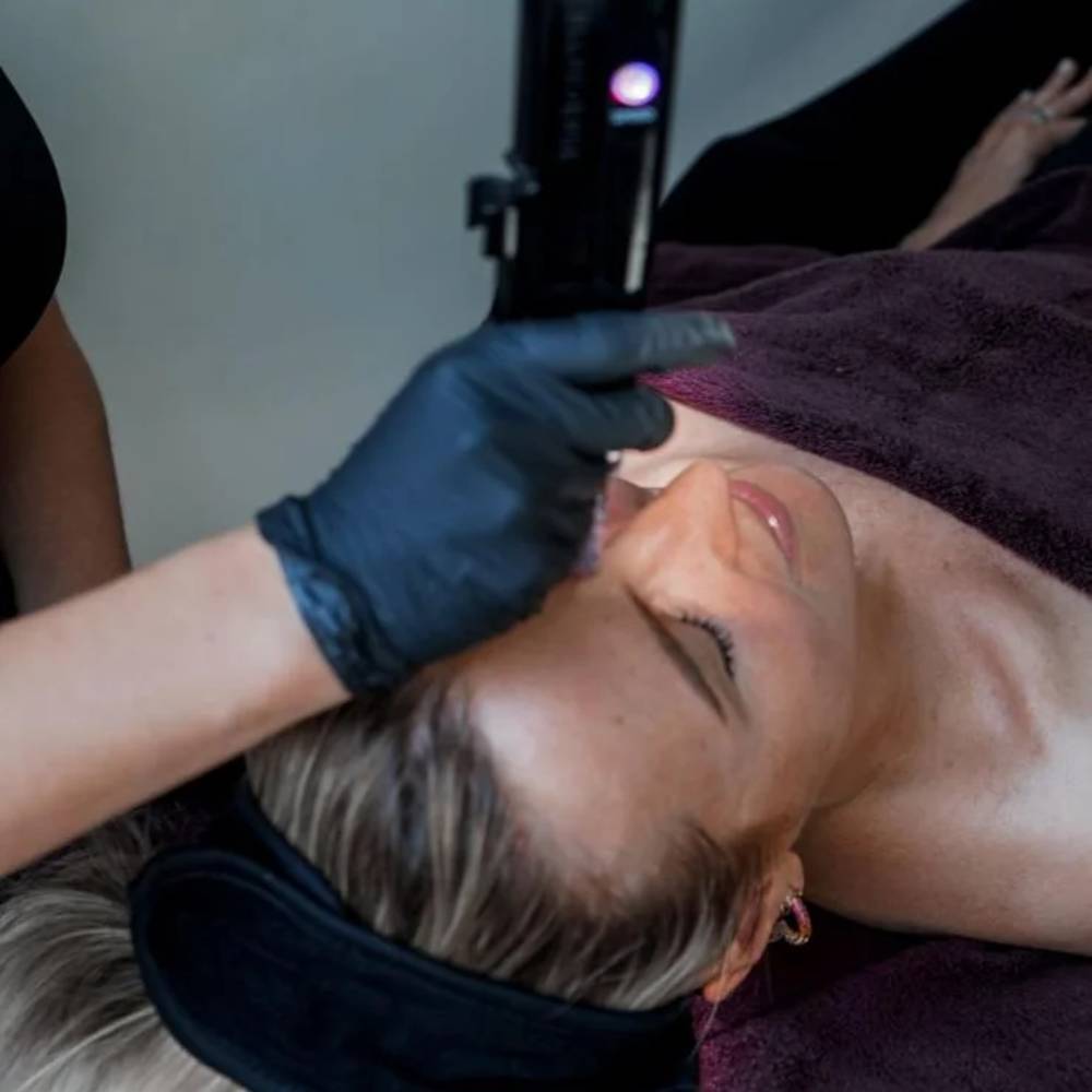 Every Face Instituut - Microneedling Skinpen