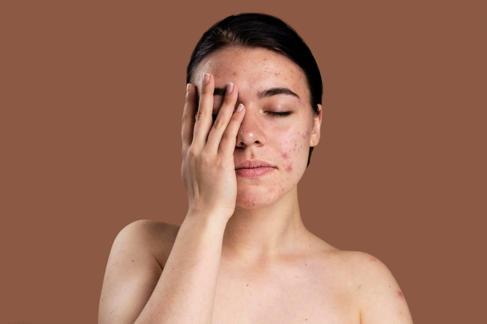 Every Face Instituut - Huidkliniek voor Mesotherapie, microneedling & meer