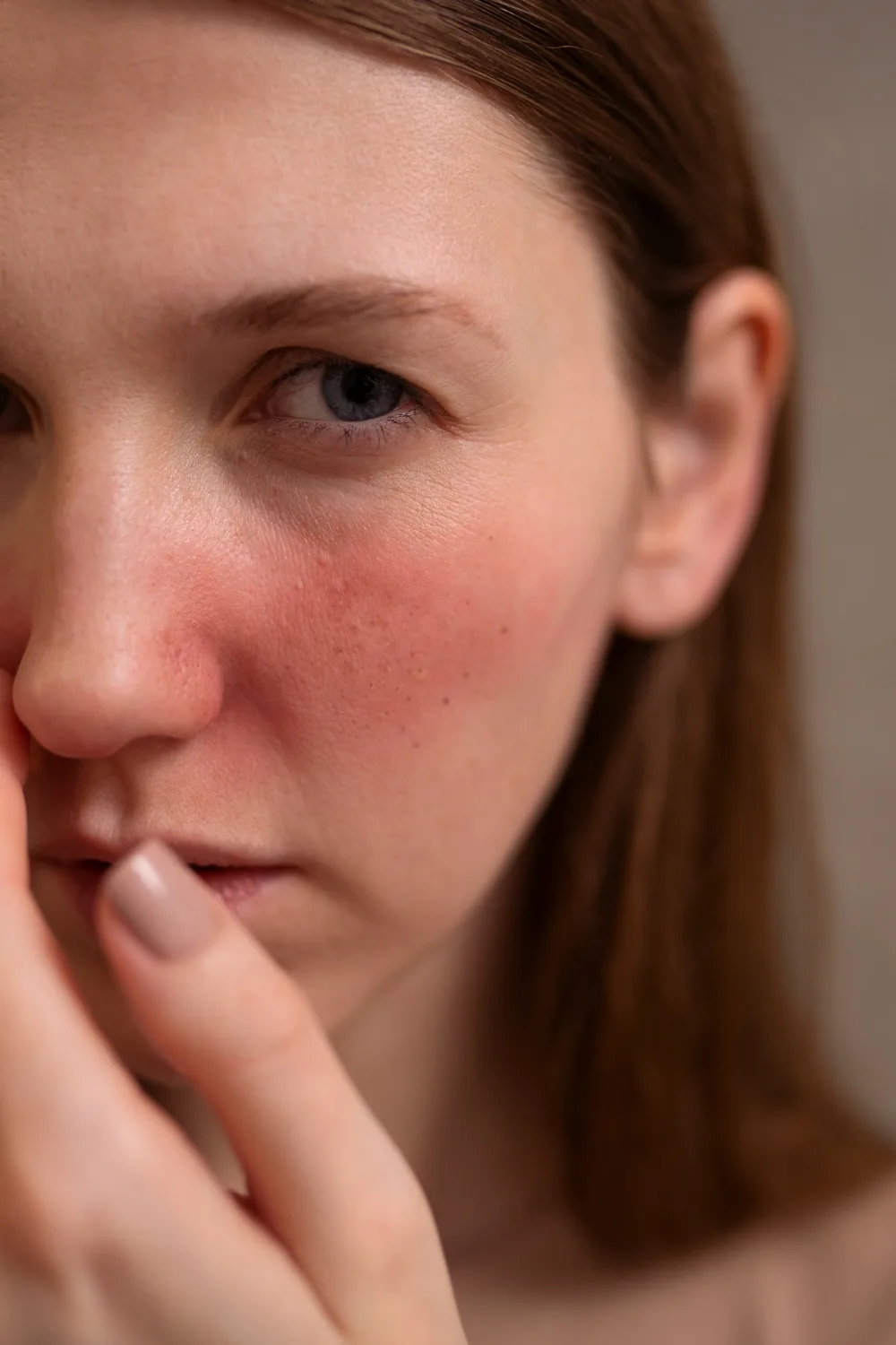 Huidproblemen en behandelingen bij Every Face Instituut