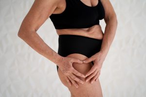 Ontdek de cellulitisbehandeling bij Every Face Institute Jouw huidkliniek in Groningen