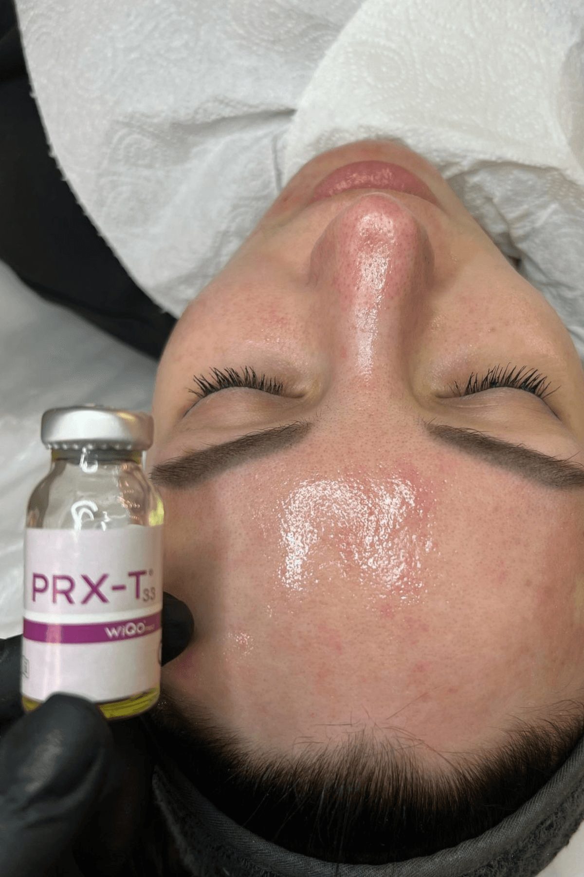 PRX-T33 Skin Boost - Every face Instituut