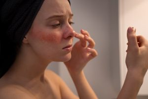 Rosacea zorgt voor een rood en vlekkerig gezicht. Ben jij benieuwd wat je tegen rosacea kunt doen en welke behandelingen echt werken EFI Groningen legt uit!