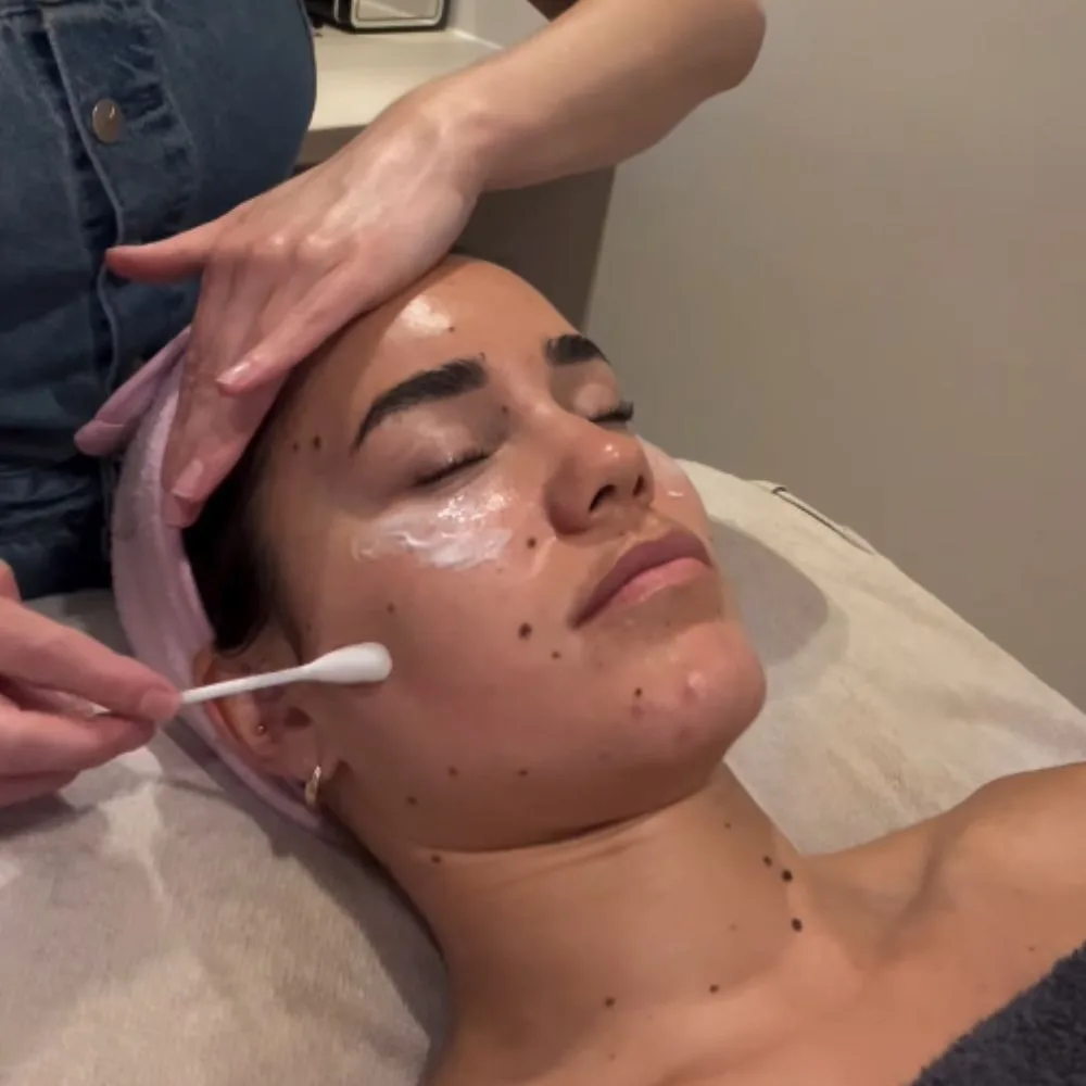 Medische Peelings - Huidkliniek Groningen